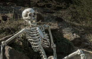 Knochen, Schädel, Körperteile Knochen, Schädel, Körperteile